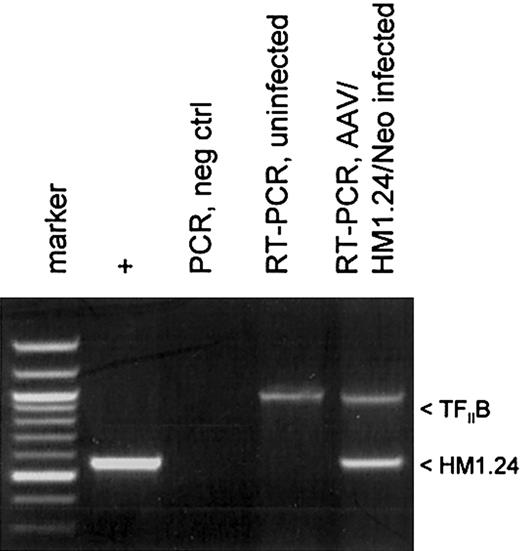Figure 3. HM1.24 mRNA expression in infected DCs. Total RNA was isolated from 2 cell populations: mock-infected and AAV/HM1.24/Neo-infected adherent monocytes at 72 hours after infection. These samples were analyzed by RT-PCR and PCR, as indicated, for the presence of HM1.24 RNA, as described in “Materials and methods.” The positive control was the PCR product resulting from using the AAV/HM1.24/Neo vector plasmid as a template. Another control was RT-PCR analysis for the cellular TFIIB mRNA. Note that only RNA from cells infected with AAV/HM1.24/Neo virus resulted in an appropriate RT-PCR–sized product, whereas mock-infected cells did not.