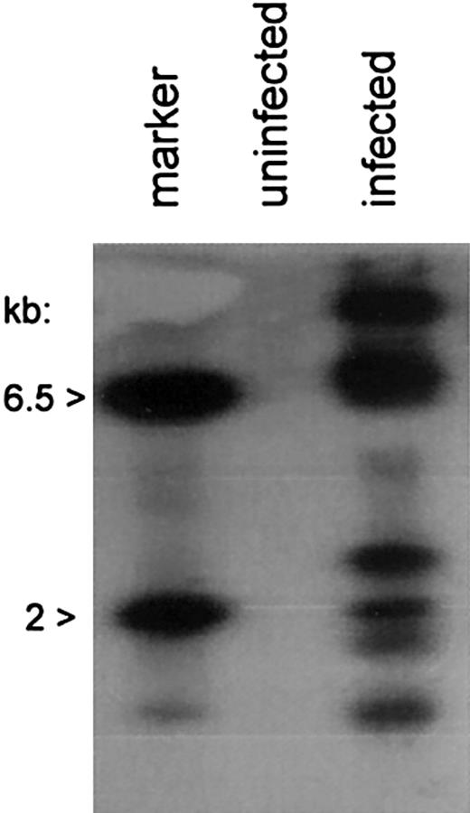 Figure 4. Chromosomal integration by AAV/HM1.24/Neo in DCs. Cells, treated as indicated and as described in “Materials and methods” and sorted for CD83 expression, were further analyzed for chromosomally integrated AAV/HM1.24/Neo viral genomes. Total cellular DNA (0.1 μg) from infected, CD83+-selected, and uninfected cells served as a template in PCR amplification assays using primers targeting the SV40 early promoter of the vector and the cellular repetitive AluI element. The products underwent Southern blotting and were probed with 32P-Neo DNA. The positive control lane contained 100 ng BamHI-digested AAV/HM1.24/Neo plasmid (6.5 kb and 2 kb). Note that multiple Neo-positive bands resulted from the infected cell population, indicating chromosomal integration by the vector, and that multiple vector-positive cell clones were present in the population.