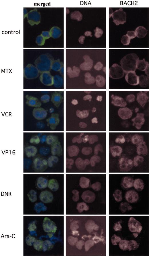 Figure 6. Antileukemic agents that generate intracellular ROS induce the nuclear accumulation of BACH2. BACH2-overexpressing RAJI cells (no. 67) were treated with drugs at the indicated concentrations—control, not treated; MTX, 0.02 μg/mL; VCR, 0.01 μg/mL; VP16, 2 μg/mL; DNR, 0.2 μg/mL; and Ara-C, 0.1 μg/mL—a day after culture. Cells were fixed and then stained for Bach2 proteins and for DNA. The merged images show BACH2 (green) and DNA (blue). Original magnification, × 400.