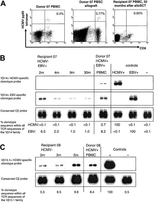 Figure 2. Following D+/R- alloSCT, HCMV pp65-specific CD8+ T cells were undetectable in HCMV-seronegative recipient of alloSC transplant 07, but an immunodominant HCMV-specific donor CD8+ T-cell clone was detectable in recipient 08 who developed severe GVHD. (A) Gated on CD3+ T cells. MHC class I HCMV pp65417-426 tetramer+ CD8+ T cells were present in donor 07 PBMCs and allograft but were undetectable in recipient 07 at 30 months after alloSCT. (B) With the use of clonotypic probing, the Vβ14+ donor CD8+ T-cell clone specific for HCMV pp65417-426 (clone 7.1) was not detectable in any of the sequential peripheral blood samples taken from recipient 07 following alloSCT. Weekly blood tests for HCMV DNA were consistently negative. In the same donor-recipient pair, the Vβ14+ donor CD8+ T-cell clone specific for EBV EBNA3C880-891 (clone 7.2) was detected in recipient PBMCs at all time points tested following alloSCT. In the controls, the HCMV+and EBV+-labeled lanes refer to the positive control cDNA used from clones 7.1 and 7.2, respectively. (C) The Vβ13.1+ donor CD8+ T-cell clone specific for HCMV pp65495-503 (clone 8.1) was detectable in sequential peripheral blood samples taken from recipient 08 after alloSCT. Recipient 08 had severe GVHD and died at 6 months after alloSCT. Weekly blood tests for HCMV DNA were negative.