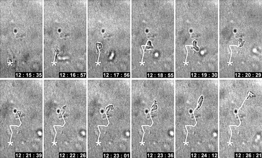 Figure 1. Spontaneous locomotion of an activated CD4+ T cell within 3D collagen lattice. Changes in morphology and oscillatory path development. CD4+ ConA blast migrating in a 3D collagen matrix in the absence of a chemotactic gradient. The average velocity was 6 μm/min. Time is indicated in hh:mm:ss (11 minutes total).