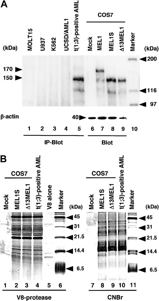 Figure 3. Expression of MEL1S in the t(1;3)(p36;q21)-positive leukemia cells. (A) Cell extracts from t(1;3)(p36;q21)-positive or -negative leukemia immunoprecipitated with anti-MELDBD1 antibody were separated by 6% SDS–polyacrylamide gel electrophoresis followed by immunoblotting with the anti-MELDBD1 antibody (IP-Blot). Also, extracts from COS7 cells with each CMV expression vector were used as controls for immunoblotting analysis (Blot). Lanes represent MOLT15 (lane 1); U937 (lane 2); K562 (lane 3); UCSD/AML1 (lane 4); the t(1;3)(p36;q21)-positive leukemia cells (lane 5); and COS7 cells with a mock vector (pCMV; lane 6), MEL1 (pCMV-MEL1; lane 7), or MEL1S (pCMV-MEL1S; lane 8); and Δ13MEL1 (pCMV-Δ13MEL1; lane 9). As an internal control for immunoblot, a 40-kDa band of β-actin was shown at the bottom (lanes 6-9). Molecular weight markers (lane 10) are given in kilodaltons. (B) SDS-PAGE of polypeptides derived from V8 protease digestion or CNBr cleavage of MEL1S, Δ13MEL1, and the 150-kDa band from t(1;3)-positive leukemia. The first 5 lanes are V8 protease–digested samples from COS7 cells transfected by a mock vector (lane 1), MEL1S (lane 2), or Δ13MEL1 (lane 3), the 150-kDa band from t(1;3)-positive leukemia cells (lane 4), and V8 protease alone (lane 5). The last 4 lanes are CNBr cleavage samples indicated at the top of each lane. Molecular weight markers (lanes 6 and 11) are given in kilodaltons.