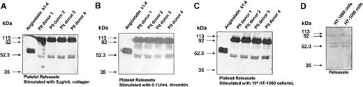 Figure 2. Western blot analysis. Analysis for platelet-derived angiostatin from 4 donors in releasates from platelets (Plt) aggregated with 5 μg/mL collagen (A), 0.1 U/mL thrombin (B), and 104/mL HT-1080 cells (C). Western blot analysis for angiostatin in the medium of cultured HT-1080 cells (D).