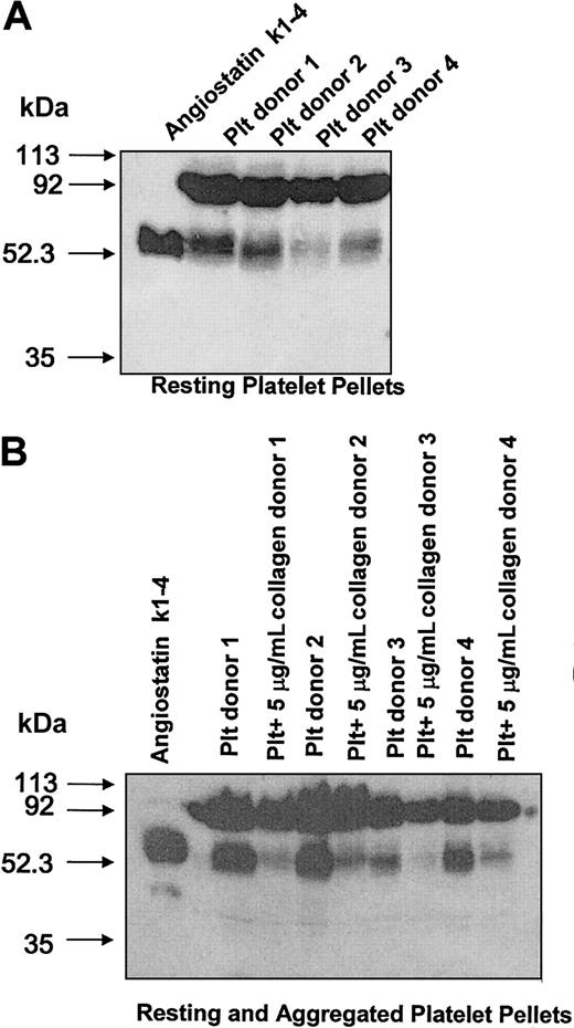 Figure 3. Western blot analysis for platelet angiostatin from platelet pellets of 4 donors.