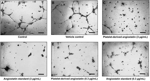 Figure 5. An endothelial capillary tube formation assay was used to test the effects of platelet-derived angiostatin. A total of 5 × 104 HUV-EC-C cells were plated out per well, resulting in tube formation. Microscopy of representative experiments: (A) control and (B) vehicle control. Effects of platelet-derived angiostatin and 50 kDa angiostatin standard on capillary tube formation: (C) 3 μg/mL platelet-derived angiostatin, (D) 3 μg/mL 50 kDa angiostatin standard, (E) 0.3 μg/mL platelet-derived angiostatin, and (F) 0.3 μg/mL 50 kDa angiostatin standard. Bar represents 100 μm.