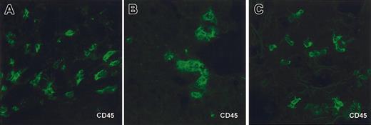 Figure 1. Human cells in tissues of NOD/SCID mice engrafted with human CD34+HPC. Immunofluorescence and confocal microscopy analysis of frozen tissue sections from organs of NOD/SCID mice engrafted with human CD34+ HPC. Staining of skin (A), liver (B), and lung (C) sections with anti–human CD45-FITC. Control staining on spleen sections include isotype control and anti–human CD45-FITC staining on tissue from mice that did not receive human cells (not shown). Sections are from tissues harvested from the same one mouse (no. 4 from experiment 1 in Table 1, which received a transplant of 3 × 105 cord blood CD34+ HPCs). CD45 staining was found in tested samples, harvested from different cohorts of engrafted mice, of skin from 5 mice, liver from 10 mice, and lung from 10 mice. Original magnification, × 63.