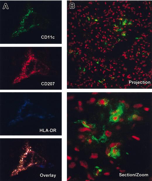 Figure 2. Immature human DCs in tissues of NOD/SCID mice engrafted with human CD34+ HPC. Immunofluorescence and confocal analysis of frozen tissue sections from skin (A; 3 of 3 tested mice) and lung (B; 6 of 6 tested mice) of NOD/SCID mice engrafted with human CD34+ HPC. (A) Staining with anti–human CD11c-FITC (green), anti–human Langerin-TxR (CD207, red) and anti–human HLA-DRCy5 (blue). Single fluorescence and overlay (no. 4 from experiment 1 in Table 1, which received a transplant of 3 × 105 cord blood CD34+ HPCs). Note the colocalization of Langerin and HLA-DR in cytoplasmic compartments consistent with immature DC phenotype in the skin (× 63 magnification with zoom of × 2. (B) Anti–human HLA-DR-FITC and 7AAD nuclei staining in the lung (projection × 40 magnification and section at zoom × 2). Note intracellular localization of anti–HLA-DR staining. HLA-DR staining was either direct with FITC-conjugated mAb or indirect with streptavidin and is representative of tested samples of lung harvested from 10 different engrafted mice. Note the large infiltration of human cells in the lung as well as dendritic morphology of HLA-DR+ cells.