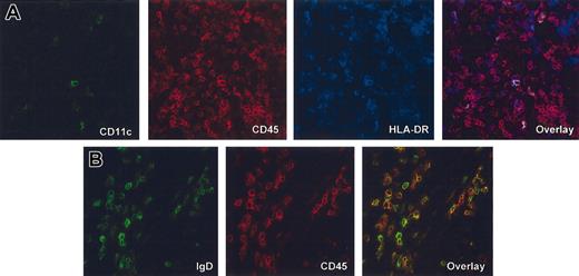 Figure 3. Spleen contains predominantly human B cells and only rare human DCs. Immunofluorescence and confocal analysis of frozen tissue sections of spleen harvested from different cohorts of mice (A, mouse that received a transplant of 6 × 105 fetal liver CD34+ HPCs; and B, mouse that received a transplant of 5 × 106 adult peripheral blood CD34+ HPCs. (A) Triple staining with anti–human CD11c-FITC (green), anti–human CD45-TxR (red) and anti–human HLA-DR-Cy5 (blue). Single fluorescence and overlay at × 40 magnification. Note only few cells with the phenotype of mDCs. (B) Double staining with anti–human IgD-FITC (green) and anti–human CD45 TxR (red). Single fluorescence and overlay at × 63 magnification.