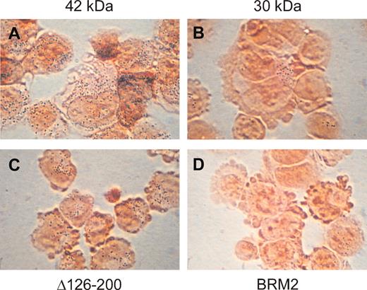 Figure 2. C/EBPα 30-kDa and BRM2 mutant proteins cannot induce granulocytic development of K562 cells with C/EBPα 42-kDa and mutant proteins. Shown are pictures of K562 cells stably transfected with the 42-kDa (A), 30-kDa (B), Δ126-200 (C), and BRM2 (D) C/EBPα-ER fusion proteins 3 days after induction of nuclear localization of the fusion protein with β-estradiol. NBT activity can be detected by the small blue dots observed after counterstaining the cells with safranin. As indicated in Table 1, less than 1% of BRM2 stably transfected cells stained positive; a single positively staining cells is shown in this field. Original magnification, × 1000.