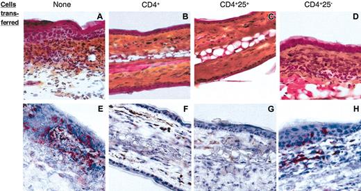 Figure 5. CD4+ CD25+ T cells prevent CD8+-mediated skin inflammation. Ears from the same Ii°/° recipients as those in Figure 3 were harvested 96 hours after DNFB challenge. Cryostat sections of ears were either stained with hematoxylin/phloxin/safran (A-D) or with an anti-CD8 mAb (red) and counter-stained with hematoxylin (E-G). Original magnification, × 40. No CD8-specific staining or local inflammatory reaction was detected in sections of ears from nonsensitized animals (not shown).