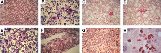 Figure 4. Increase in platelets in the peripheral blood and in megakaryocytes in bone marrow and spleen of induced double transgenic hCD34tTA × BCR/ABL mice. Cells in panels were stained with Wright Giemsa, except for panel H, which demonstrates Gr-1 staining (brown color) with a hematoxylin counterstain. (A) Peripheral blood and (B) bone marrow from a nontransgenic littermate are shown. Thrombocytosis developed within several months after induction of BCR/ABL expression (C-D, peripheral blood). Consistent with this finding in peripheral blood was an increase in the number of megakaryocytes in the bone marrow. (E) Stains of a cytospin of bone marrow cells and (F) a bone marrow section from another animal are shown. High numbers of megakaryocytes were also found in the spleens of induced animals (G) as well as invasion of myeloid cells into the liver (H). Original magnification, × 20.