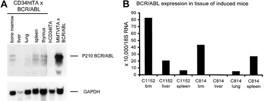 Figure 6. BCR/ABL RNA is expressed in hematopoietic tissues of hCD34tTA-BCR/ABL mice. (A) RNA expression of the oncogene is shown in hematopoietic tissues, including bone marrow, spleen, and thymus, but not from liver or lung detected by Northern blot analysis. RNAfrom the lymph node of a MMTVtTA-BCR/ABL animal that died of pre-B-cell leukemia6 was used as a positive control, whereas bone marrow from a single-transgenic littermate served as a negative control. Total RNA (20 μg) was loaded in each lane and probed with a BCR/ABL-specific probe, followed by hybridization to GAPDH. (B) Result is shown of quantitative real-time PCR to detect and quantify the expression of BCR/ABL in the same animal whose tissue was used for Northern blot analysis in panel A (C814) and from a second double transgenic animal that died of BCR/ABL related disease (C1152).