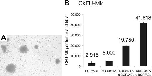 Figure 8. Increase of megakaryocytes and their progenitors in the bone marrow of double transgenic mice. CFU-MK assay with subsequent staining for megakaryocyte-specific acetylcholinesterase was performed on bone marrow cells from 1 BCR/ABL single transgenic, 1 hCD34tTA single transgenic, and 2 hCD34tTA-BCR/ABL double transgenic mice. Panel A shows the typical megakaryocytic morphology of the CFU in agar from a double transgenic animal (original magnification, × 100), and (B) shows the number of CFU-MKs per femur and tibia. The error bars indicate the standard deviation on the basis of counting duplicate wells. The number of colonies found in CD34tTA-BCR/ABL bone marrow cells was increased 7-fold.