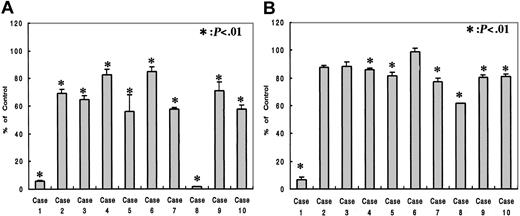 Figure 4. Effects of R115777 on the growth of fresh myeloma cells from patients. The cells were cultured in quadruplicate at a density of 2.5 × 105 cells/mL in 96-well flat-bottomed tissue-culture plates with concentrations of 0 (control) and 1.0 × 10-7 M (A) or 1.0 × 10-8 M (B) of R115777 for 72 hours at 37°C in a humidified atmosphere of 5% CO2 in air. R115777 inhibited the growth of fresh myeloma cells in all patients examined at 1.0 × 10-7 M and 7 of 10 patients at 1.0 × 10-8 M, but the degree of inhibition differed among the patients. Values represent means ± SDs of quadruplicate cultures. *P < .01.