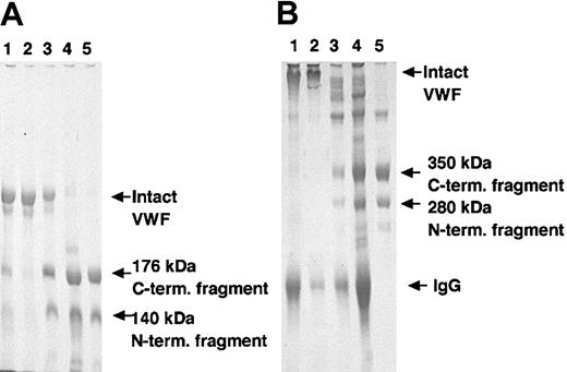 Figure 5. Inhibitory activity of VWF-CP activity of rADAMTS-13 by autoantibodies purified from plasma of patients with acquired TTP. Three IgG fractions were separately purified from 3 patients with acquired (idiopathic) TTP. Preincubated conditioned medium of recombinant wild-type ADAMTS-13 with 10 mM BaCl2 was mixed with an equal volume of purified patient A-C IgGs, (lanes 1-3), healthy IgG (lane 4), or buffer (lane 5), respectively. Then these mixtures were incubated with an equal volume of purified VWF followed by overnight dialysis against 5 mM Tris-HCl, pH 8.0, containing 1.5 M urea at 37°C. An aliquot of each reaction mixture was subjected to 5% SDS-PAGE. The gel was stained with Coomassie Brilliant Blue R-250. (A) Under reducing conditions; (B) under nonreducing conditions.