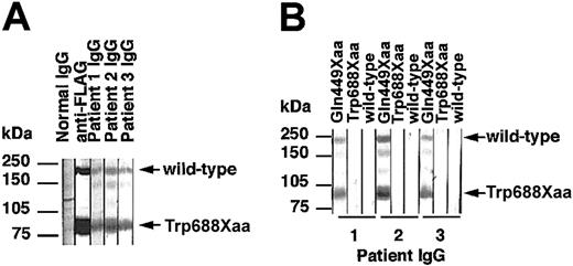 Figure 7. Precise epitope mapping of IgG fractions from patients with acquired TTP by competitive immunoblot analysis. Two culture medium samples, one from cells transfected with the full-length wild-type plasmid and the other from cells transfected with the Trp688Xaa plasmid, were premixed, subjected to SDS-PAGE, and blotted onto polyvinylidene diflouride membranes. (A) Each blot was reacted with healthy IgG, anti-FLAG M2 MoAb, or IgGs prepared from 3 patients. (B) Each blot was reacted with IgGs prepared from 3 patients in the presence of 10-fold concentrated cultured media of cells transfected with either the Gln449Xaa, the Trp688Xaa, or the full-length wild-type plasmid.