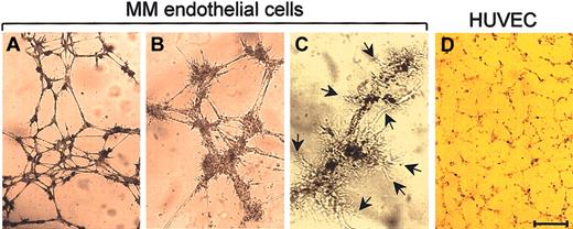 Figure 3. Capillarogenic activity of MMECs compared with HUVECs. Cells were seeded on matrigel in the specific complete medium and after an 8-hour incubation their 3-dimensional organization was examined planimetrically. A patient's cells formed (A) branching, anastomosing tubes with (B) multicentric junctions, resulting in a network of capillary-like structures and (C) extroversions of cell membranes (arrows), suggesting sproutive growth. (D) HUVECs formed a loose and poorly organized network. The network in (A) has area percentage of 29.2, length of 7670, branching of 43, mesh of 38; that in (D) has area percentage of 16.3, length of 4110, branching of 21, mesh of 12. Bar = 70 μm (A,D), 30 μm (B), and 18 μm (C).