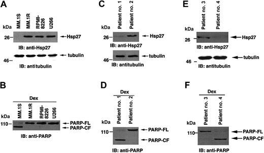 Figure 1. Expression of Hsp27 correlates with Dex sensitivity and Dex resistance in MM cells. (A) Total cell lysates from MM.1S, MM.1R, RPMI-8226, and U266 MM cells were prepared. Lysates were separated by 10% SDS-PAGE and analyzed by immunoblotting (IB) with anti-Hsp27 or anti-tubulin antibodies. (B) Cells were treated with 5 μM Dex for 24 hours and analyzed for apoptosis by PARP cleavage. Lysates were subjected to immunoblot analysis with anti-PARP antibody. (C,E) Expression of Hsp27 in purified patient MM cells. Lysates from patient MM cells (Dex sensitive, patients no. 1 and 4) and (Dex resistant, patients no. 2 and 3) were subjected to immunoblot analysis with anti-Hsp27 and antitubulin antibodies. (D,F) Patient MM cells were treated with 5 μM Dex for 24 hours and analyzed for apoptosis by PARP cleavage. Lysates were subjected to immunoblot analysis with anti-PARP antibody. Blots are representative of 3 independent experiments with similar results. FL indicates full length; CF, cleaved fragment.
