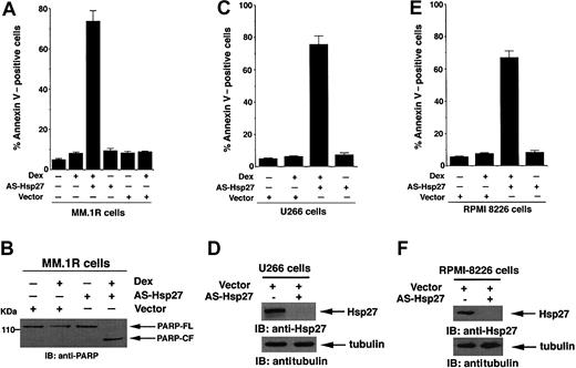 Figure 3. Dex triggers apoptosis in AS-Hsp27-transfected Dex-resistant cells. (A,B) MM.1R cells were transiently transfected with either GFP-tagged AS-Hsp27 (WT) or with empty vector. Following transfections, GFP+ cells were selected by flow cytometry; treated with Dex (5 μM) for 72 hours, and analyzed for apoptosis by annexin V staining (A) and PARP cleavage (B). Median apoptosis was 73% ± 2% in response to Dex plus AS-Hsp27 and 8.1% ± 0.6% in response to Dex plus vector alone (P < .003; n = 3). Cells were also treated with 5 μM Dex for 24 hours and analyzed for apoptosis by PARP cleavage. Lysates were subjected to immunoblot analysis with anti-PARP antibody. Blot shown is representative of 3 independent experiments with similar results. FL indicates full length; CF, cleaved fragment. (C) U266 cells were transiently transfected with either GFP-tagged AS-Hsp27 (WT) or with empty vector. Following transfections, GFP+ cells were selected by flow cytometry; treated with Dex (5 μM) for 72 hours, and analyzed for apoptosis by annexin V staining. Median apoptosis was 74% for Dex plus AS-Hsp27 and 6% for Dex plus vector alone (P < .004; n = 3). (D) Functional specificity of AS-Hsp27 was determined by subjecting protein lysates from AS-Hsp27-transfected or control vector-transfected U266 MM cells to immunoblot analysis with anti-Hsp27 (upper panel) or anti-tubulin antibodies (lower panels). (E) RPMI-8226 cells were transiently transfected with either GFP-tagged AS-Hsp27 (WT) or with empty vector. Following transfections, GFP+ cells were selected by flow cytometry; treated with Dex (5 μM) for 72 hours, and analyzed for apoptosis by annexin V staining. Median apoptosis was 67% for Dex plus AS-Hsp27 and 9% for Dex plus vector alone (P < .005; n = 3). (F) Functional specificity of AS-Hsp27 was determined by subjecting protein lysates from AS-Hsp27-transfected or control vector-transfected U266 MM cells to immunoblot analysis with anti-Hsp27 (upper panel) or anti-tubulin antibodies (lower panel). Error bars in A, C, and E represent standard deviation.