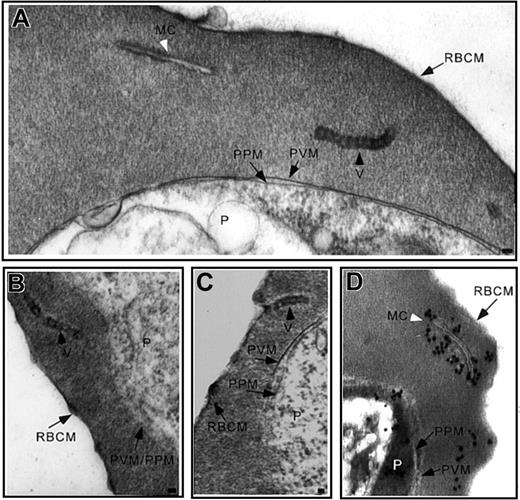 Figure 1. Incubation of IRBCs with AlF reveals vesicle chains. (A-B) Ultrastructural characterization of glutaraldehyde-fixed trophozoite stage IRBCs revealed vesicles with an electron-dense limiting membrane arranged in chains in the RBC cytosol (black arrowhead) or (C) closely apposed to the erythrocyte plasma membrane. A typical Maurer cleft is observed (A; white arrowhead). (D) Immunoelectron microscopy confirmed the long, slender unit membranes in the RBC cytosol are Maurer clefts. MC indicates Maurer cleft; P, parasite; PVM, parasitophorous vacuolar membrane; PPM, parasite plasma membrane, RBCM, red blood cell membrane; and V, vesicles. Scale bar = 70 nm.