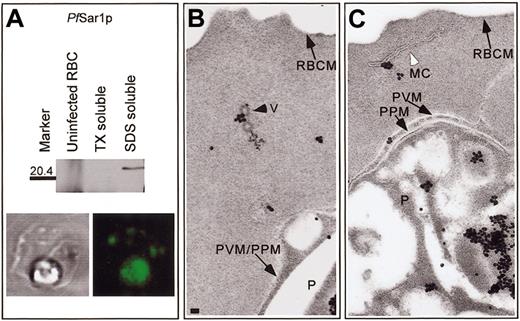 Figure 2. Pf Sar1p is associated with coated vesicles and Maurer clefts. (A) Western blot analysis of uninfected and IRBCs incubated with AlF demonstrated that Pf Sar1p was an approximate 23-kDa Triton X-100-insoluble, SDS-soluble protein that was absent in uninfected RBCs. IFA showed Pf Sar1p localized to the parasite compartment and structures in the RBC cytosol. Immunoelectron microscopy revealed Pf Sar1p associated with (B) coated vesicles (V), black arrowhead, and (C) Maurer clefts (MC), white arrowhead, within the RBC cytosol. Scale bar = 70 nm.