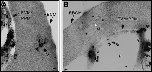 Figure 3. Pf EMP1 is associated with coated vesicles and Maurer clefts. Trophozoite stage IRBCs were treated with AlF, processed for immunoelectron microscopy and probed with an α-Pf EMP1 antibody. Pf EMP1 associated with (A) the parasite compartment and coated vesicles in the RBC cytosol and (B) Maurer clefts. Scale bar = 70 nm.