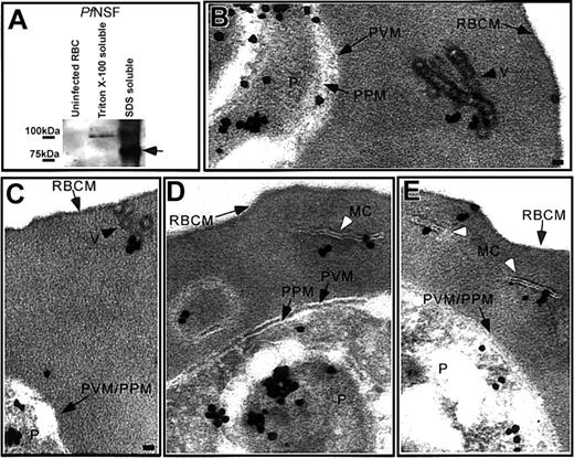 Figure 4. Pf NSF is associated with coated vesicles and Maurer clefts. (A) Western blot analysis of uninfected RBCs and IRBCs showed that Pf NSF was an approximate 89-kDa Triton X-100-insoluble, SDS-soluble protein that was absent in uninfected RBCs. Immunoelectron microscopy showed Pf NSF associated with (B) chains of coated vesicles in the RBC cytosol, black arrowhead, (C) coated vesicles closely apposed to the RBC membrane, black arrowhead, (D-E) the Maurer clefts, white arrowhead, (D) a large, double membrane structure in the RBC cytosol, and (E) transitional areas between a Maurer cleft and the RBC membrane. Scale bar = 70 nm.