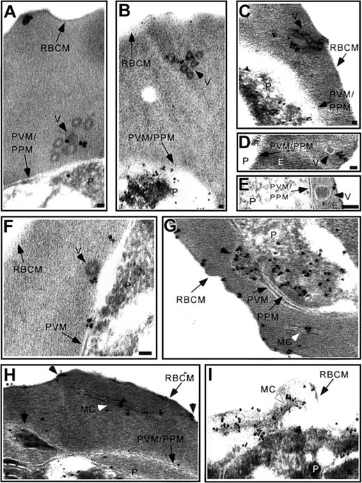 Figure 5. Actin is associated with intraerythrocytic transport vesicles. Trophozoite stage IRBCs were treated with AlF and processed for immunoelectron microscopy using an antiactin antibody. Actin associated with the RBC membrane and (A-B) coated vesicles in the RBC cytosol, (C) vesicle chains in the RBC cytosol closely apposed to the RBC membrane, and (D-E) vesicles (arrowhead) with a translucent limiting membrane and electron dense contents closely apposed to the RBC membrane. (F) Actin in close proximity to a coated vesicle budding from the PVM, black arrowhead, (G) concentrated in protruding areas of the PVM, black arrowhead, (H) associated with the Maurer clefts, which appeared to extend to actin-rich areas (black arrowheads) and a protruding, electron-dense area of the PVM (short arrow) that was similar in appearance (translucent limiting membrane and electron-dense contents) to the vesicles in panels D and E. (I) Maurer clefts in IRBCs permeabilized with streptolysin O maintained their parallel orientation and appeared to be tethered to the RBCs and parasite membranes via actin. Scale bar = 70 nm.