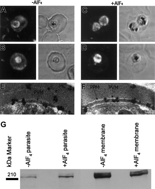Figure 6. RBC myosin association with the PVM appears to be G protein-mediated. (A-B) In the absence of AlF, myosin was associated with the RBC membrane and PVM and diffusely distributed in the RBC cytosol. (C-D) AlF perturbs the myosin distribution to an almost exclusive association with the PVM and some structures in the RBC cytosol. (E-F) Immunogold EM revealed myosin to be associated with the PVM and Maurer clefts in AlF-treated IRBC. (G) Western blots showing that AlF causes a loss of myosin from the RBC membrane and stabilization at the PVM. In A-D, 1 mm equals 700 nm. Original magnification E-F, × 20 000.