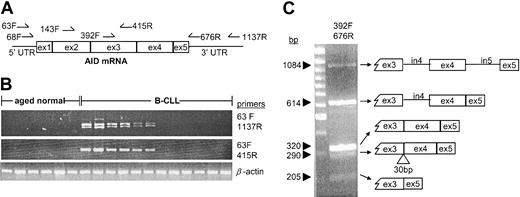 Figure 1. Some B-CLL samples express the AID full-length transcript and its splice variants. (A) Map of the PCR primers used showing their relative position on the AID mRNA sequence (GenBank no. AB040431). Exons are indicated by boxes and noncoding regions by lines. (B) Representative RT-PCR results from purified B cells from healthy individuals of similar age and a series of B-CLL cases. Each vertical lane represents one patient or subject. Full coding sequence using primer pair 63F and 1137R (upper panel). First 3 exons using primer pair 63F and 415R (middle panel). β-actin (lower panel). (C) The region between exon 3 and exon 5 contains multiple variants. PCR products from CLL332 using the primer pair 392F and 676R were run on a 2% agarose gel (left). The total PCR product was cloned, and individual clones representing each band were sequenced using M13 primers. The sequences are diagrammed at right. From the bottom: variant missing exon 4 (205 bp), variant lacking the first 30 bp of exon 4 (290 bp), full-length transcript (320 bp), variant retaining the intron 4 sequence (614 bp), variant containing intron 4 and intron 5 (1084 bp). The last variant is identical to the genomic sequence of AID and most likely arose from genomic DNA contaminating the RNA used for the RT-PCR.