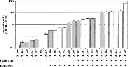 Figure 2. Quantitation of AID message in B-CLL cells. Quantitative real-time PCR was performed on cDNA from purified B-CLL cells, and the relative expression units are plotted on a log scale. The open bars represent the B-CLL cases with less than 2% nucleotide difference from the corresponding germ line Ig V region gene, and the filled bars are B-CLL cases with 2% or more differences. The results of either single or nested AID-specific RT-PCR for the same samples are shown below the graph. The single PCR used the primers 63F and 1137R for 33 cycles. Nested PCR was performed on the single PCR products using the primers 68F and 676R for 15 cycles.