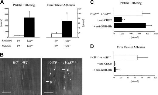 Figure 1. Role of VASP in the regulation of platelet adhesion in the common carotid artery in vivo. (A) Platelet–endothelial cell interactions were investigated in VASP–/– mice by in vivo fluorescence microscopy of the common carotid artery in situ. Wild-type animals served as controls. The panels summarize platelet tethering (left) and firm platelet adhesion (right). Tethered and adherent platelets were classified according to their interaction with the endothelial cell lining as described in “Materials and methods” and are given per mm2 of vessel surface. Mean ± SEM, n = 8-10 each group; * indicates significant difference compared with wild-type mice; P < .05. (B) The microphotographs show representative in vivo fluorescence microscopy images. White arrows indicate adherent platelets. Bars represent 50 μm. Role of P-selectin and GPIIb-IIIa for platelet tethering (C) and firm platelet adhesion (D) in VASP null mice. VASP–/– mice were injected with 50 μg function-blocking anti–P-selectin or anti–GPIIb-IIIa mAb, respectively, prior to in vivo videofluorescence microscopy. Untreated VASP null mice served as controls. Tethered and adherent platelets were classified according to their interaction with the endothelial cell lining as described in “Materials and methods” and are given per mm2 of vessel surface. Mean ± SEM; n = 6-7 carotid arteries; * indicates significant difference compared with untreated VASP null mice; P < .05.