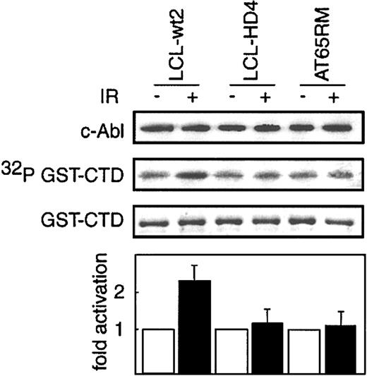 Figure 3. ATM-dependent c-Abl activation in vitro. Whole lysates of cells from a healthy subject (LCL-wt2), patient HD4 (LCL-HD4), and a patient with AT (AT65RM) were immunoprecipitated with anti–c-Abl antibody before (–) and 1 hour after (+) X-irradiation (10 Gy). Immunoprecipitated c-Abl protein (detected by Western blotting with anti–c-Abl antibody; top panel) was used in an in vitro kinase assay with recombinant GST-CTD as the substrate (detected with Coomassie brilliant blue; third panel), phosphorylation of which is shown by 32P incorporation (by autoradiography; second panel). Extents of phosphorylation of recombinant GST-CTD after X-irradiation are shown relative to that before X-irradiation (= 1) (bottom graph). Data represent mean values from 3 independent experiments.