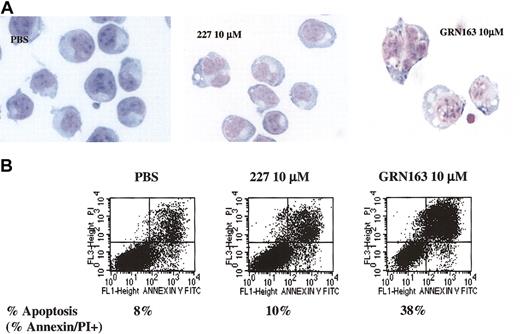 Figure 5. Morphologic changes, apoptosis, and cell death induced in CAG myeloma cells (TRF, 2.7 kb) after 7 days of in vitro GRN163 (10 μM) treatment. CAG myeloma cells (1 × 105) were prepared in 6-well plates with PBS, GRN163 (1-10 μM), or a mismatch oligonucleotide control 227 (10 μM). Cells were harvested, counted, and replated in the presence of fresh drug on day 4. On day 7 of treatment, cells were collected and (A) viewed under × 60 light microscopy for morphologic changes. (B) Dual-color staining of cells for annexin/PI uptake indicative of cell apoptosis and necrosis was also performed.
