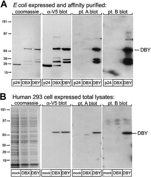 Figure 1. Reactivity of patient plasma with recombinant human DBY and DBX proteins. (A) Recombinant p24, DBY, and DBX proteins produced in E coli were probed in Western blots with antibodies specific for the V5 epitope tag and plasma obtained from 2 male patients after allogeneic HSCT. The location of the full-length recombinant DBY protein is indicated by the arrow. (B) Recombinant DBY and DBX were expressed in human female 293 cells, and total cell lysates were probed in Western blots with antibodies specific for the V5 epitope tag and plasma obtained from the same male patients shown in panel A. Results with DBY and DBX are compared with 293 cells transfected with an empty vector (mock transfectants). The location of the full-length recombinant DBY protein is indicated by the arrow.