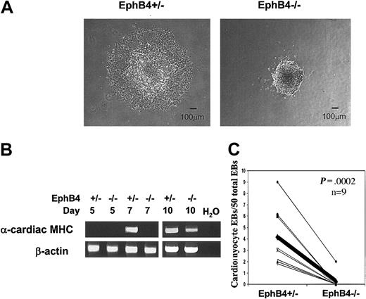 Figure 6. Influence of EphB4 on cardiac myocyte differentiation. (A) Morphology of EB after attaching to gelatin-coated culture plates. (B) RT-PCR analysis of cardiac muscle–specific gene, α-cardiac myosin heavy chain (α-cardiac MHC). (C) EBs with beating cardiomyocytes. Paired data are linked by a line from the same experiment (n = 9). The thick line indicates the mean of 9 experiments.