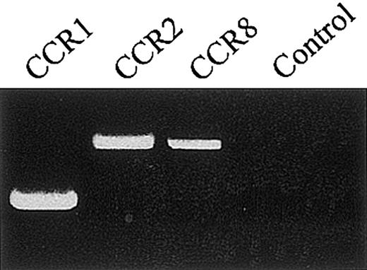 Figure 6. Analysis of CCR1, CCR2, and CCR8 mRNA expression in HUVECs. RT-PCR was performed on RNA of HUVECs grown in complete medium by using specific primers and conditions indicated in “Materials and methods.” In the control sample, the reverse transcription reaction was not performed and RNA was used instead of cDNA. The size of amplification products of CCR1, CCR2, and CCR8 were respectively 360, 583, and 540 bp. The figure is representative of 3 experiments performed.