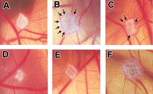 Figure 12. Angiogenesis in CAMs induced by CCL16-Cos. CAMs were recorded at day 12 of incubation, 96 hours after the implant of a gelatin sponge soaked with Vec-Cos (A), CCL16-Cos at 100 ng (B) or 50 ng (C), or with CCL16-Cos (100 ng) neutralized by an Ab anti-CCL16 (D). Panels E and F show the CAM vascularization induced by BX471 (1 μmol/sponge) alone (E) or combined with CCL16-Cos (100 ng/sponge). Arrows in B and in C indicate the new capillaries attracted by the sponge containing CCL16. Original magnifications × 250. The picture is representative of one experiment of at least 4 performed.