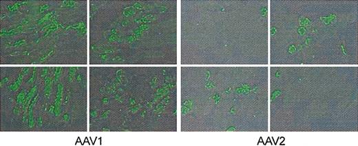 Figure 4. Immunofluorescent staining for hF.IX in AAV-injected mouse muscle. Animals were injected in the hindlimbs with 4 × 1012 vg/kg AAV-1 or AAV-2, divided equally among 4 injection sites. Twelve weeks later mice were killed and injected muscle was resected for immunofluorescent staining. Positive cells were scored by observers blinded to vector type. Representative sections from the quadriceps are shown for AAV-1– and AAV-2–injected muscle; average percent of positive cells was 54% for AAV-1, 22% for AAV-2.