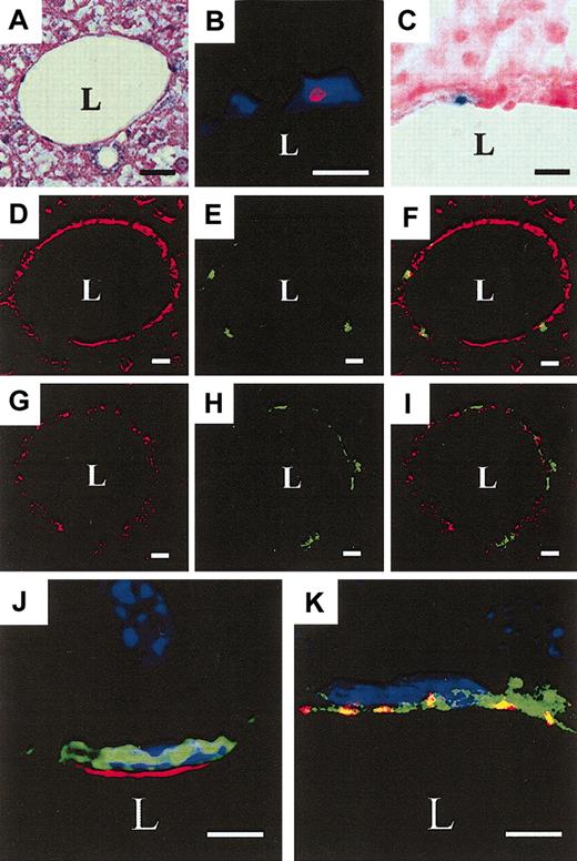 Figure 1. Bone marrow–derived cells differentiate into portal vein endothelium. Following transplantation of BM or HSCs (KSL), recipient liver was examined for donor-derived CD31+/VWF+ cells. (A) Hematoxylin and eosin stain of recipient liver tissue showing the lumen of a portal vein (L). (B) Y-chromosome–positive (red) male donor cell in the nucleus of a cell in the intima of a portal vein 8 months after KSL transplantation detected by Y-PAINT/FISH with DAPI (blue) nuclear staining. (C) X-gal detection of LacZ expression in a ROSA26 donor-derived cell (blue) in a portal vein. (D-F) A portal vein from a GFP+ KSL transplant recipient demonstrating the expression of CD31 (red, D) and GFP (green, E). (F) Merged image. (G-I) A portal vein from a GFP+ KSL recipient demonstrating the expression of VWF (red, G) and GFP (green, H). (I) Merged image. (J) Confocal microscopy images of a donor-derived GFP+, CD31+, DAPI+ cell in a portal vein; (K) a GFP+, VWF+, DAPI+ cell in a portal vein. (B,J-K, 500 KSL cells per recipient; C, 106 BM cells per recipient; D-F,G-I, 2000 KSL cells per recipient. Scale bars: A, D-I, 20 μm; B-C, 10 μm; J-K, 5 μm; L indicates portal vein lumen.)