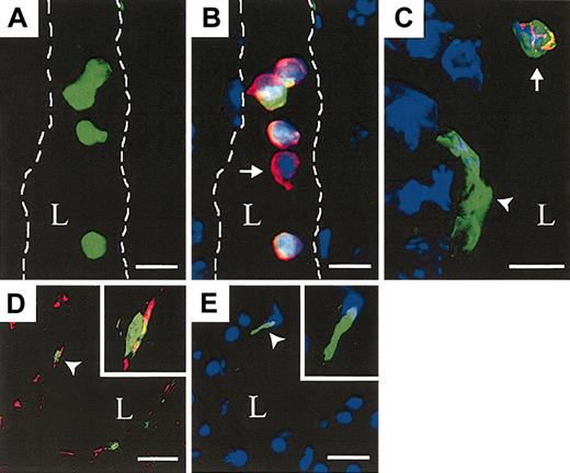 Figure 2. HSCs give rise to circulating hematopoietic cells and functional ECs. The liver of recipients that received transplants of 500 GFP+ KSL cells was evaluated. (A) GFP+ KSL cell–derived blood cells within a longitudinal section of a hepatic vessel (lumen (L) outlined, FITC channel only). (B) Merged image showing donor, GFP+ (green), DAPI+ (blue) nucleated blood cells coexpressing CD45 (red) and a single host-derived GFP–, CD45+ blood cell (arrow). (C) A portal vein with a donor DAPI+, GFP+, CD45– EC (arrowhead) near a donor DAPI+, GFP+, CD45+ blood cell (arrow). (D) Low-density lipoprotein (Dil-Ac-LDL, red) uptake in GFP+ ECs. Insert shows higher magnification of a single GFP+, Dil-Ac-LDL cell (arrow head). (E) A GFP+, CD45–, DAPI+ EC (arrowhead) within a portal vein from a 500 GFP+ KSL recipient 2 weeks after transplantation not injected with ac-LDL. Scale bars: A-B, 10 μm; C, 5 μm; and D-E, 20μm; original magnification, × 60 (D-E inserts).