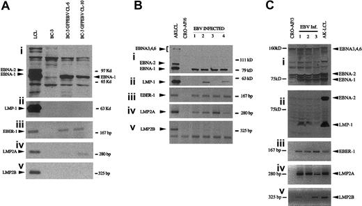 Figure 1. EBV latent gene expression in PEL cells superinfected with the recombinant EBV. Proteins were separated on 7.5% SDS-polyacrylamide gels. EBNAs were detected with a polyclonal serum. LMP1 was visualized by CS1-4 monoclonal antibodies. Akata virus–derived LCL was used as a positive control. EBER-1, LMP2A, and LMP2B were detected by RT-PCR. (A) BC-3; (B) CRO-APO/6, and (C) CRO-APO/3 and their respective EBV-infected clones. A mixture of CS1-4 and PE2 was used to detect LMP1 and EBNA-2 in CRO-AP/3 convertants.