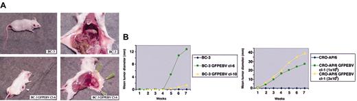 Figure 2. Tumorigenicity of PEL cells and their EBV-converted sublines in SCID mice. (A) The SCID mice were subcutaneously injected with BC-3 and its EBV convertant. The mice were killed at the seventh week after inoculation. Note the highly vascularized tumor growth of BC-3 GFPEBV cl-6, whereas the mouse inoculated with the uninfected BC-3 is tumor free. The left and the right panels show the same mouse. (B) Kinetics of tumor growth in SCID mice. Summary of the rate of tumor growth in mice inoculated with parental BC-3 and BC-3 GFPEBV cl-6 and cl-10 and CRO-AP/6 and CRO-AP/6 GFPEBV cl-1. Two different doses of both the parental CRO-AP/6 and EBV-infected cl-1 were tested. The mean tumor load was calculated by dividing the sum of tumor diameters in all mice by the total number inoculated. Mice were kept under observation between 4 and 8 weeks.