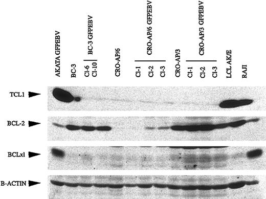 Figure 3. TCL1, BCL-2, and BCLxL expression in PEL cells and EBV-infected counterparts. Total cell lysates were run on 15% SDS-polyacrylamide gels. Monoclonal antibodies against respective proteins were used to verify their expression.