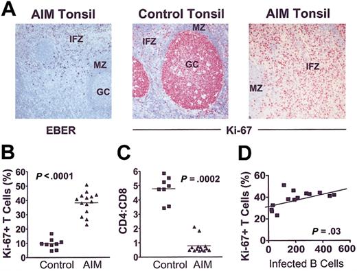 Figure 3. CD8+ T-cell proliferation is linked to extent of B-cell expansion in AIM. (A) (left panel) Acute EBV tonsil contains EBER+ cells in the IFZ (original magnification × 100). (middle and right panels) Ki-67 staining in control and AIM tonsil sections, respectively (original magnifications × 100). Proliferative activity is low in the interfollicular zones and the follicular MZ compared with GCs in control (middle panel), whereas AIM tonsils show high proliferative activity in the expanded interfollicular T-cell zones (right panel). (B) Proliferation index (percentage of Ki-67+) of interfollicular T cells is markedly increased in AIM patients compared with controls (Mann-Whitney U test; P < .0001). (C) Ratio of CD4- to CD8-expressing cells was counted exclusively in the interfollicular zones. (D) Linear regression analysis showed that the increase in proliferative activity correlated with the number of EBV-infected cells, expressed as number of EBER+ cells per 10 000 lymphocytes (r = 0.57).
