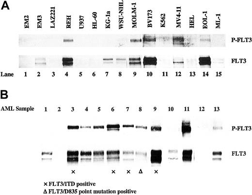 Figure 1. FLT3 is expressed and autophosphorylated in a number of human leukemia/lymphoma cell lines and primary AML blasts. Total cellular protein extracts derived from 1 × 107 cells were immunoprecipitated with anti-FLT3 antibody. The immunoprecipitates were resolved by 8% SDS-PAGE and subjected to immunoblot analysis with antiphosphotyrosine antibody 4G10 (top panel). The same blot was stripped and reprobed with anti-FLT3 antibody (bottom panel). (A) Human leukemia/lymphoma cell lines. (B) Primary AML blast samples (prior to protein preparation, newly thawed leukemic blast cells were incubated in complete medium for 12 hours).
