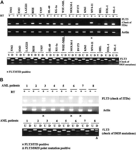 Figure 2. FLT3 transcripts are expressed by human leukemia/lymphoma-derived cell lines and primary AML blasts. Total cellular RNA was extracted from leukemia/lymphoma cell lines and patients' blast cells. RNA (50 ng-100 ng) was reverse transcribed and amplified using primer pairs for FLT3 and actin. PCR products were resolved on 2.5% agarose gel in the presence of ethidium bromide, and photographs were taken under UV transillumination. If an FLT3/ITD mutation is present, a higher molecular weight band than wtFLT3 will be visualized. To detect mutations at D835, EcoRV digestion of the PCR-amplified region including the D835 and I836 codons was used prior to electrophoresis. These codons are encoded by the sequence GATATC, which forms the EcoRV restriction site. If this site is mutated, the PCR product will be resistant to digestion. (U, undigested; D, digested.) (A) Human leukemia/lymphoma derived cell lines. (B) Primary AML blasts. Patients 3, 6, and 7 expressed FLT3/ITD mutations. Patient 8 expressed a D835 mutation.
