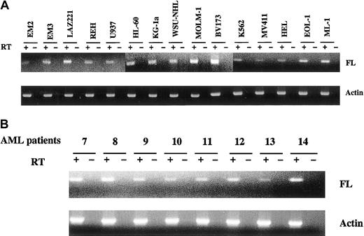Figure 3. FL transcripts are expressed by human leukemia/lymphoma-derived cell lines and primary AML blasts. Total cellular RNA was extracted from cell lines and patients' blast cells. RNA (50 ng-100 ng) was reverse transcribed and amplified using primer pairs for FL and actin. PCR products were resolved on 2.5% agarose gel in the presence of ethidium bromide, and photographs were taken under UV transillumination. (A) Leukemia/lymphoma cell lines. (B) Primary AML blast samples.
