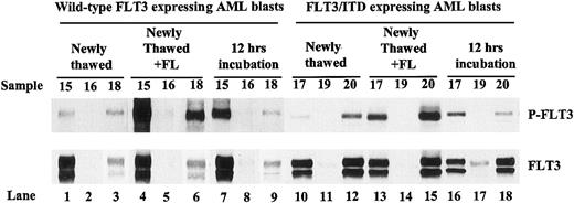 Figure 5. Incubation of leukemic blast cells in complete medium for 12 hours increases the FLT3 autophosphorylation in some primary AML specimens. Protein lysates were prepared from washed, newly thawed AML blast cells with or without FL (100 ng/mL) stimulation or after incubation for 12 hours in complete medium. Total cellular protein was immunoprecipitated with anti-FLT3 antibody. The immunoprecipitates were resolved by 8% SDS-PAGE and subjected to immunoblot analysis with antiphosphotyrosine antibody 4G10 (top panel). The same blot was stripped and reprobed with anti-FLT3 antibody (bottom panel).