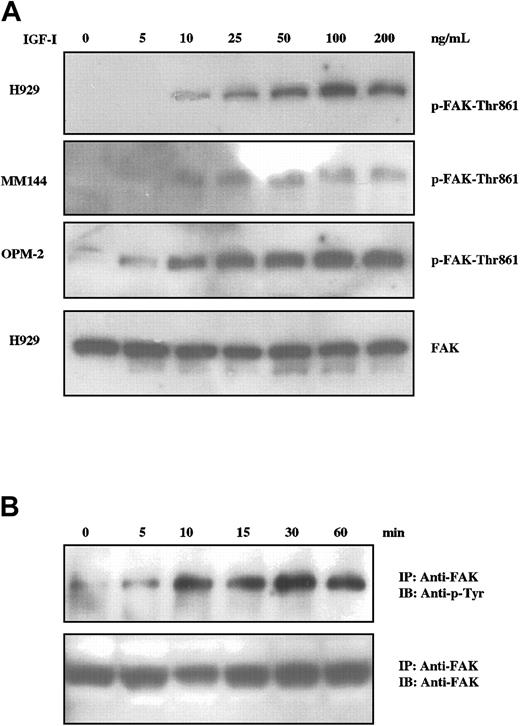 Figure 2. IGF-I induces tyrosine phosphorylation of FAK in MM cells. MM cells starved for 12 hours were not stimulated or stimulated with varying concentrations of IGF-I (5 ng/mL to 200 ng/mL; A) for 10 minutes or with 100 ng/mL for times indicated (B). Cell lysates were subjected to SDS-PAGE (A) or immunoprecipitated with anti-FAK and subjected to SDS-PAGE (B), transferred to membranes, and blotted with indicated antibodies. Membranes in panel A were stripped and reprobed with anti-FAK as controls for loading. Control blot is shown only for H929, but comparable results were observed with all lines.